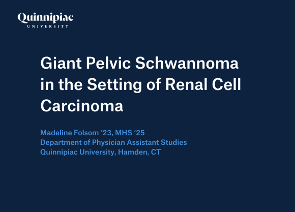 Graphic that states, "Giant Pelvic Schwannoma in the Setting of Renal Cell Carcinoma"